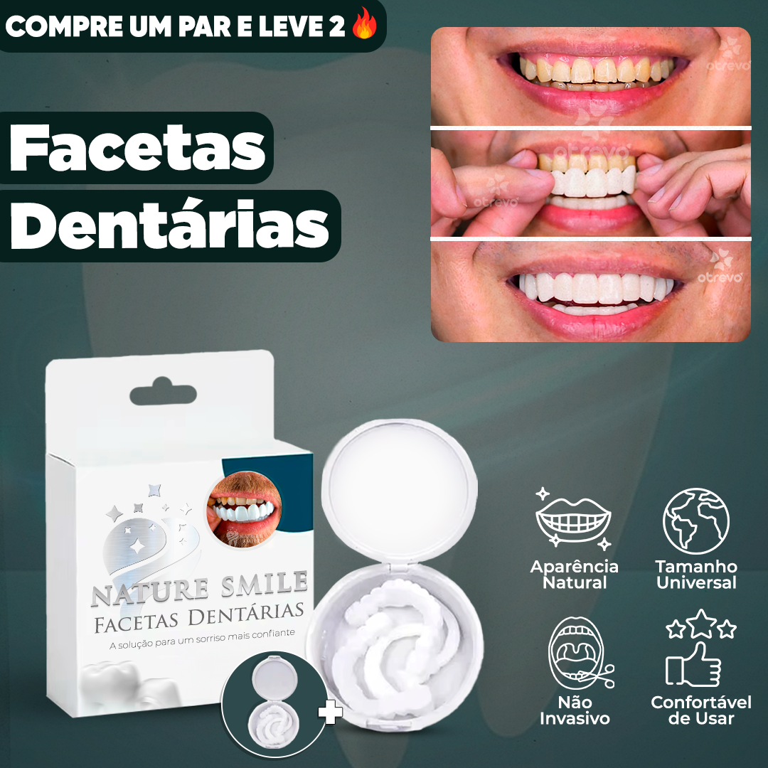 Nature Smile® - Facetas Dentárias Removíveis